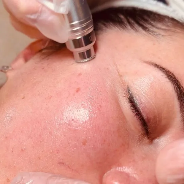Targeted pore extraction